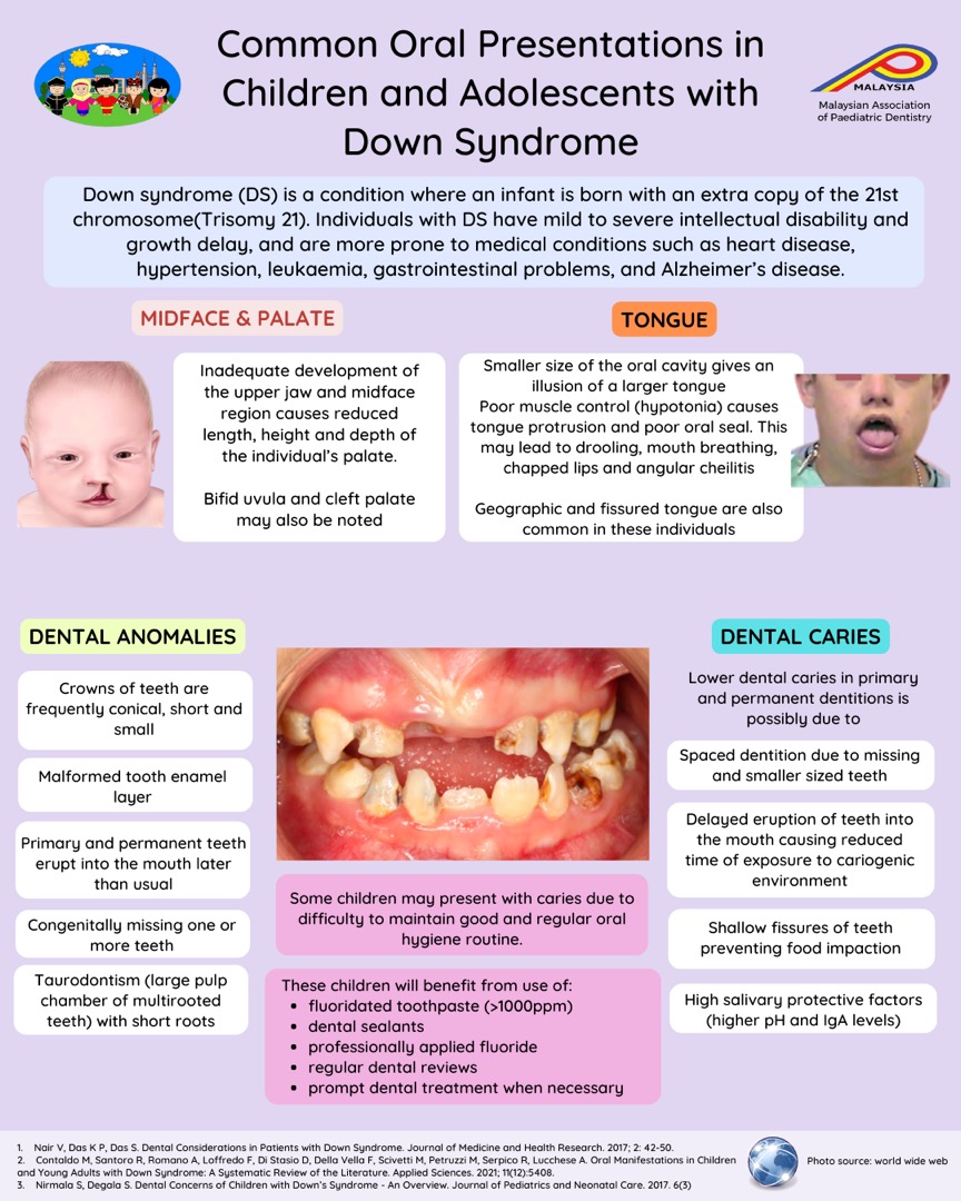 Common Oral Presentations in Children and Adolescents with Down Syndrome