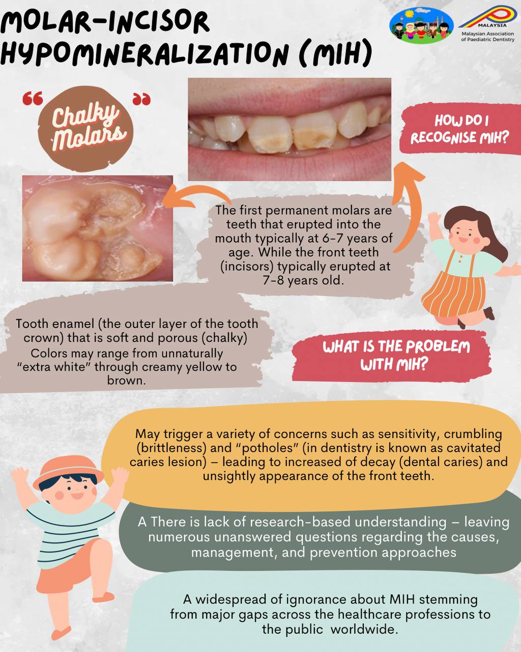Molar Incisor Hypomineralization MIH How MIH Affect Children 